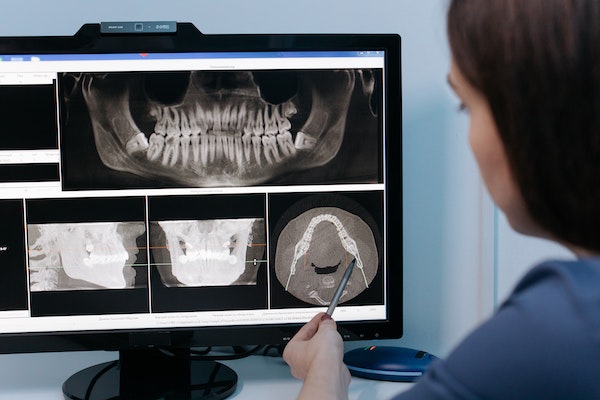 un médecin regardant une radiographie dentaire